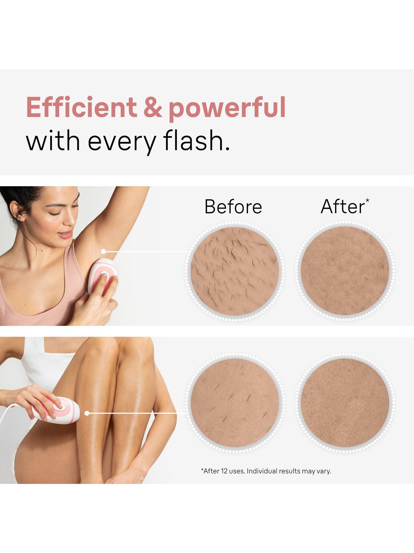  image of braun-ipl-silkmiddotexpert-mini-pl1014-latest-generation-ipl-at-home-hair-removal