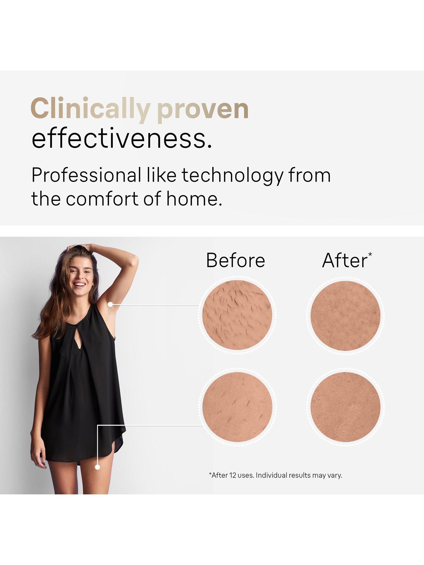  image of braun-ipl-silk-expert-pro-5-at-home-hair-removal-device-with-pouch-pl5257--nbspwhitegold
