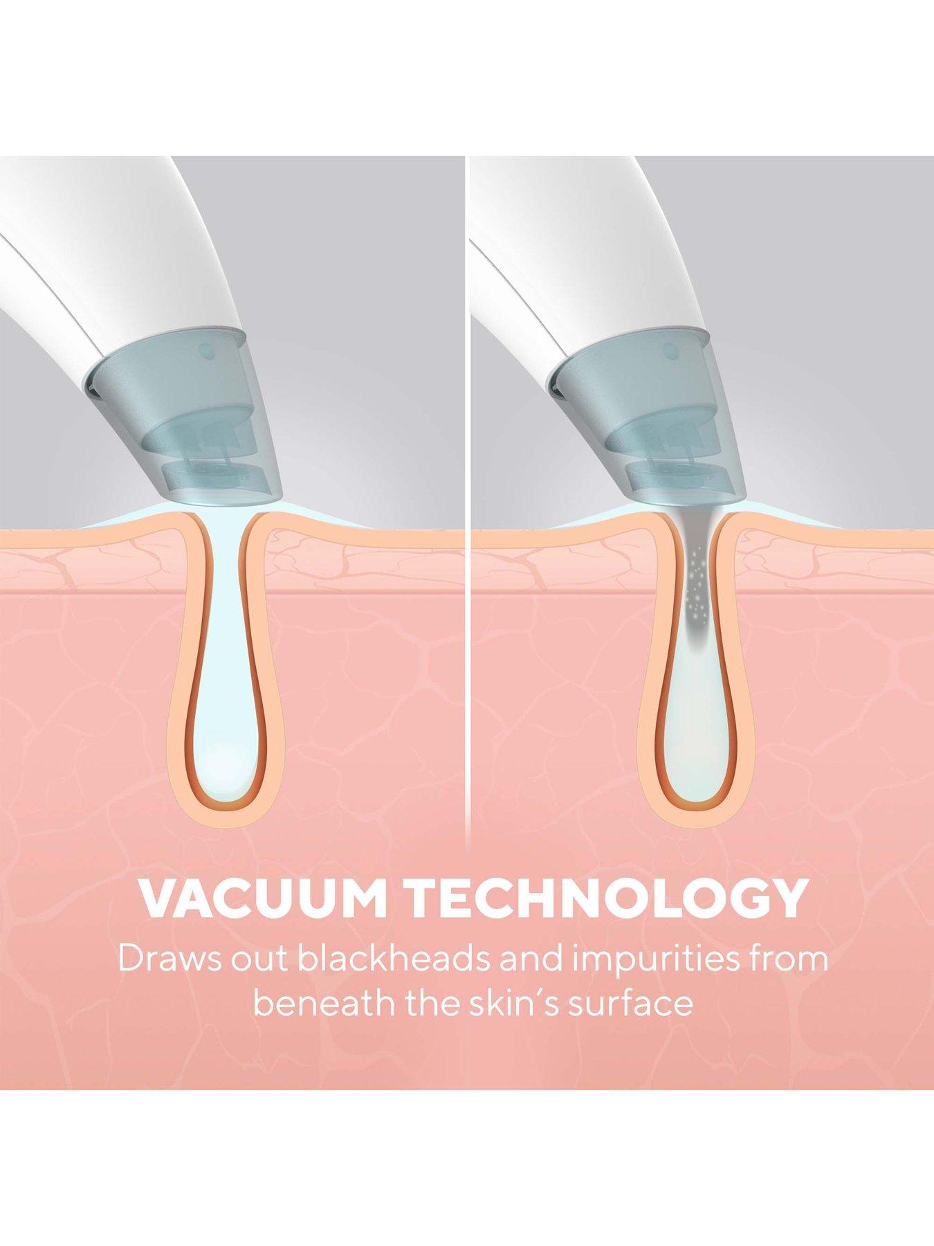  image of homedics-refresh-hydradermabrasion-cleanser