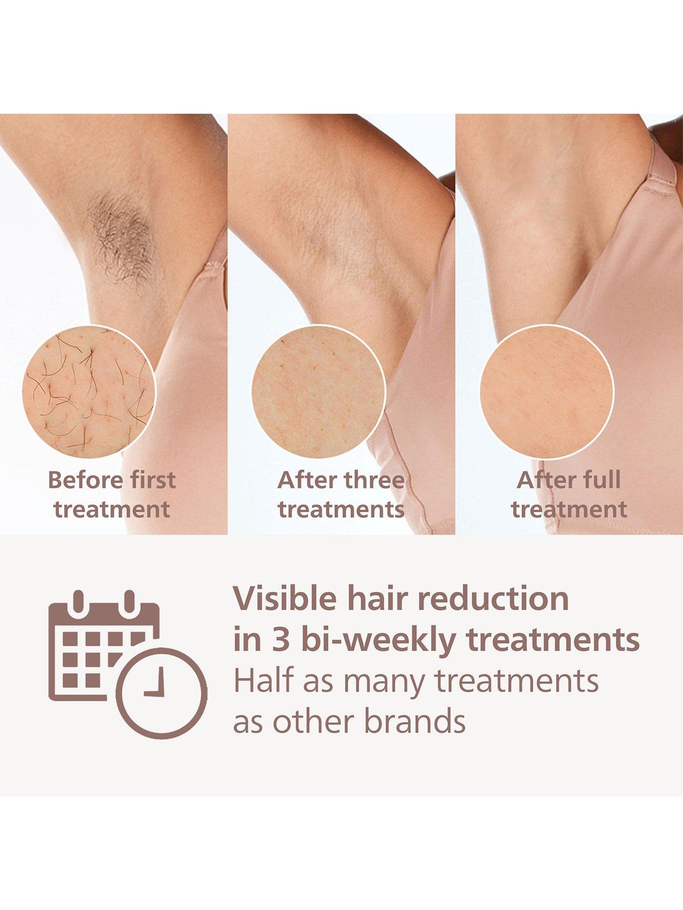 Image 3 of 8 of Philips Lumea 8000 Series, IPL Hair Removal Device, SenseIQ Technology, 4 Attachments for Body, Face, Bikini and Underarms, BRI947/00