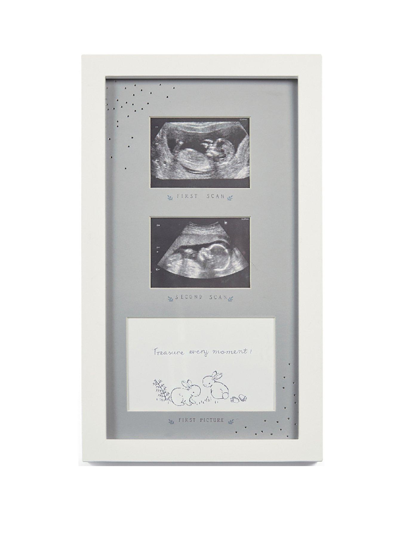 Image 1 of 1 of Mamas & Papas Baby Double Scan Photo Frame - Forever Treasured