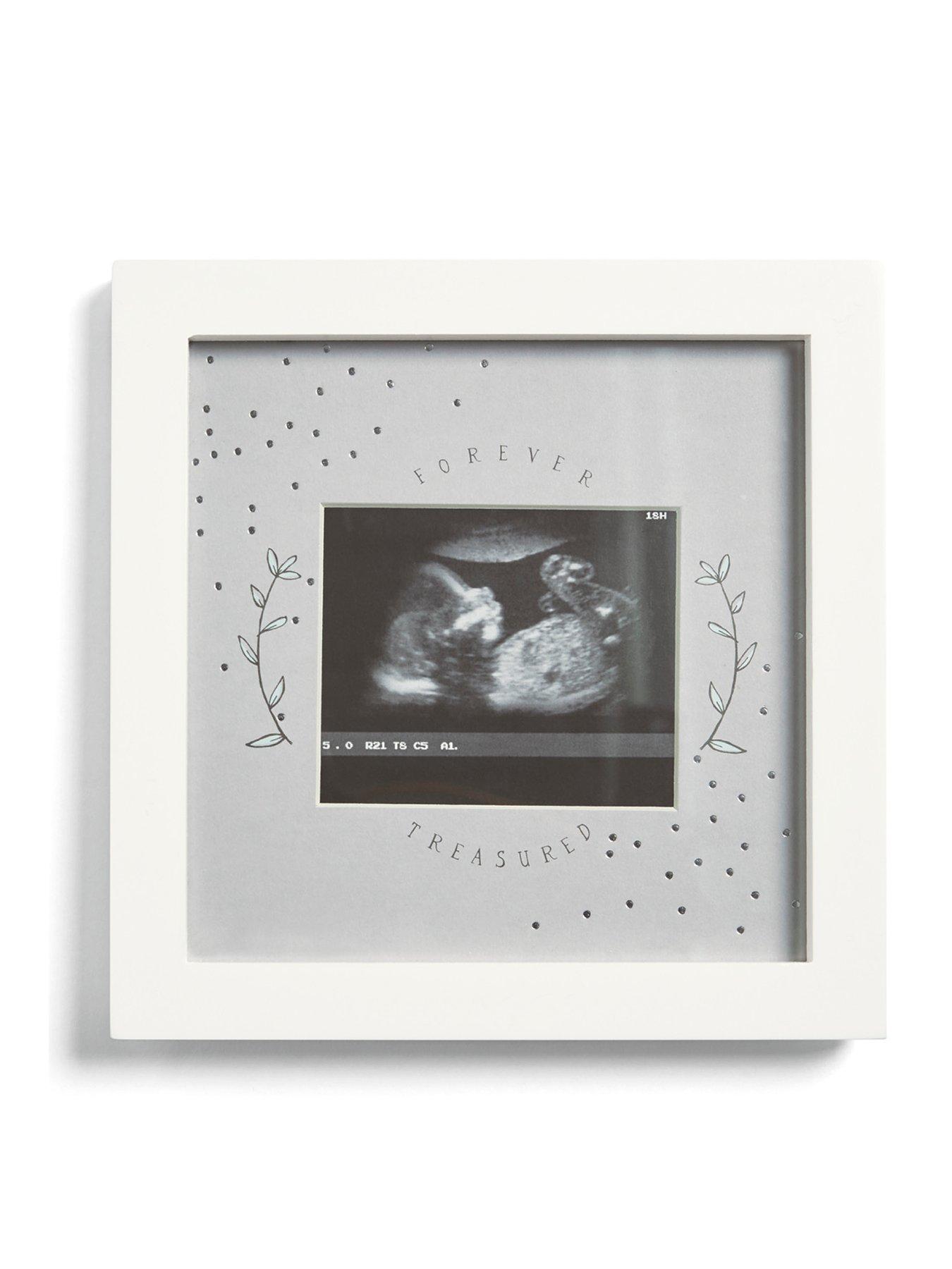 Image 1 of 1 of Mamas & Papas Baby Scan Photo Frame White - Forever Treasured