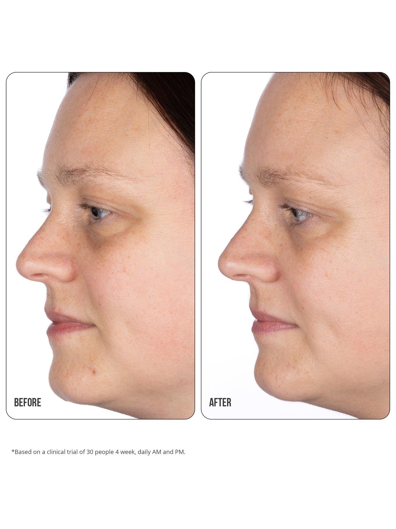 Image 5 of 5 of Nip + Fab Vitamin C Fix Eye Cream 10%