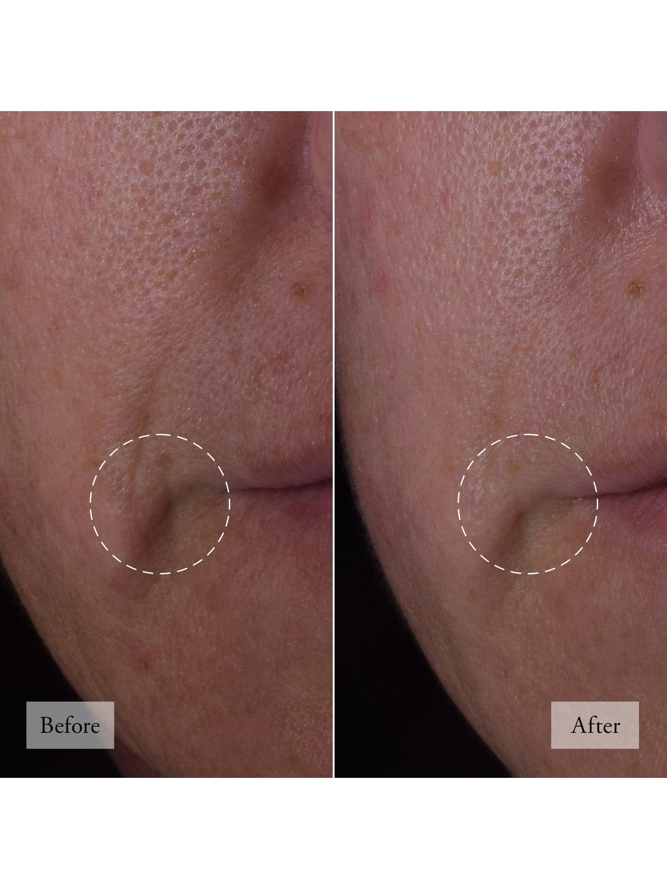 Image 2 of 8 of Philosophy dose of wisdom bouncy skin reactivating serum 30ml