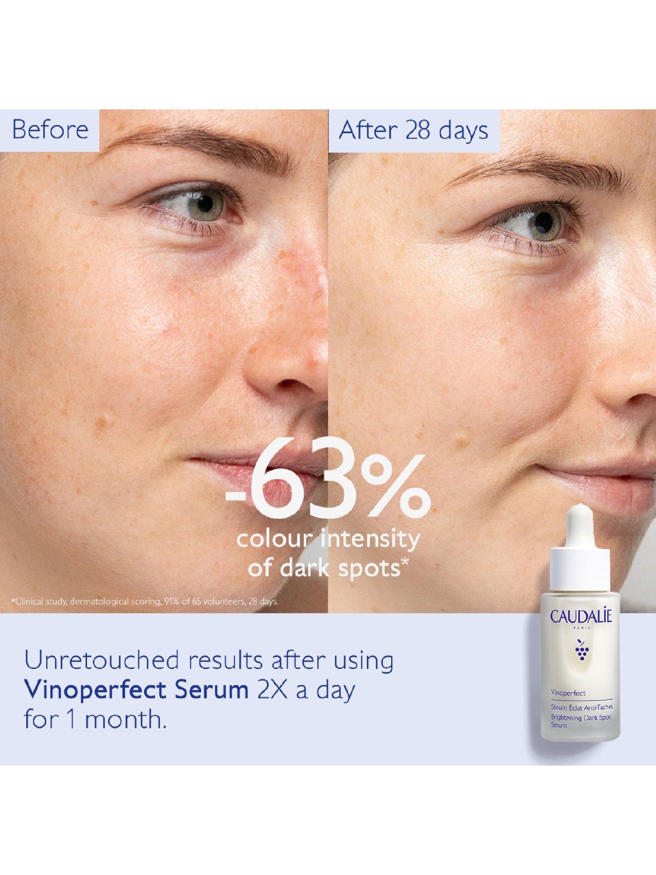  image of caudalie-vinoperfect-brightening-dark-spot-serum-30-ml