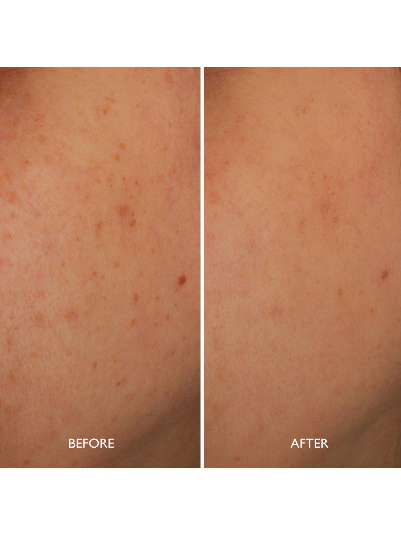  image of gatineau-age-benefit-hyperpigmentation-repair-30ml
