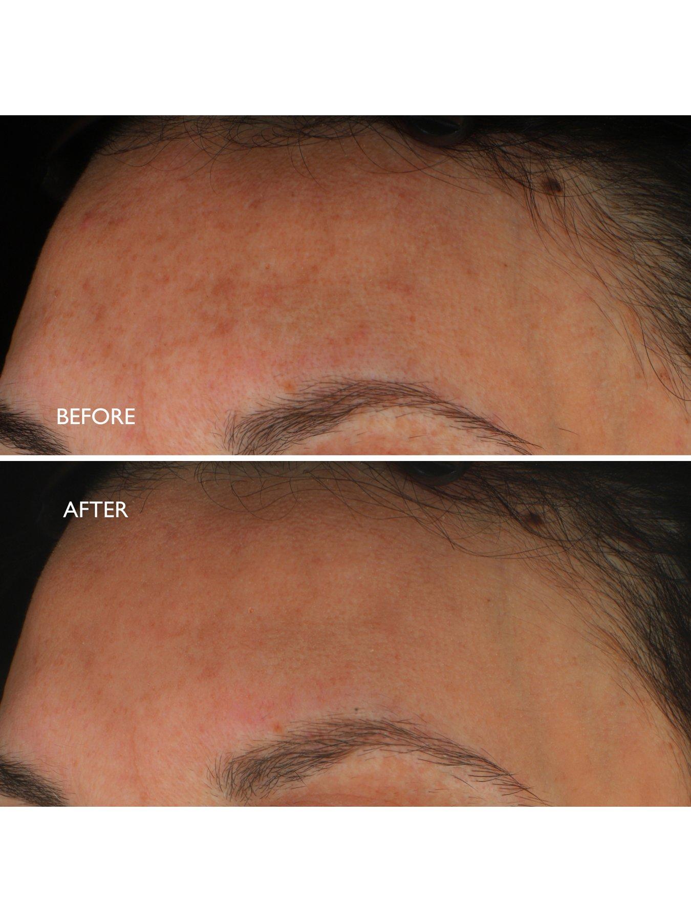  image of gatineau-age-benefit-hyperpigmentation-repair-30ml