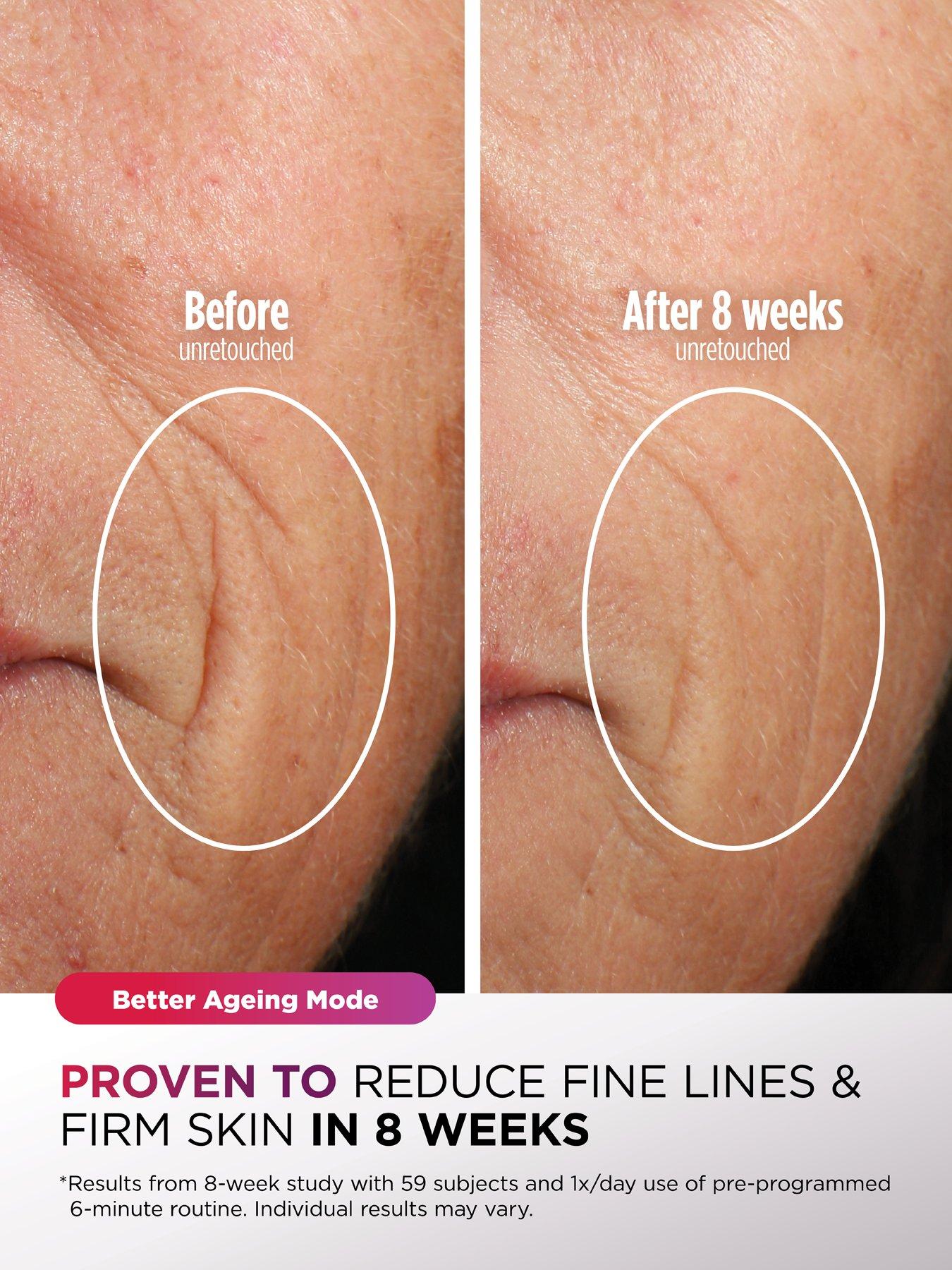 Image 5 of 7 of Shark CryoGlow Under-Eye Cooling &amp; LED Anti-Ageing Mask FW312UKPL
