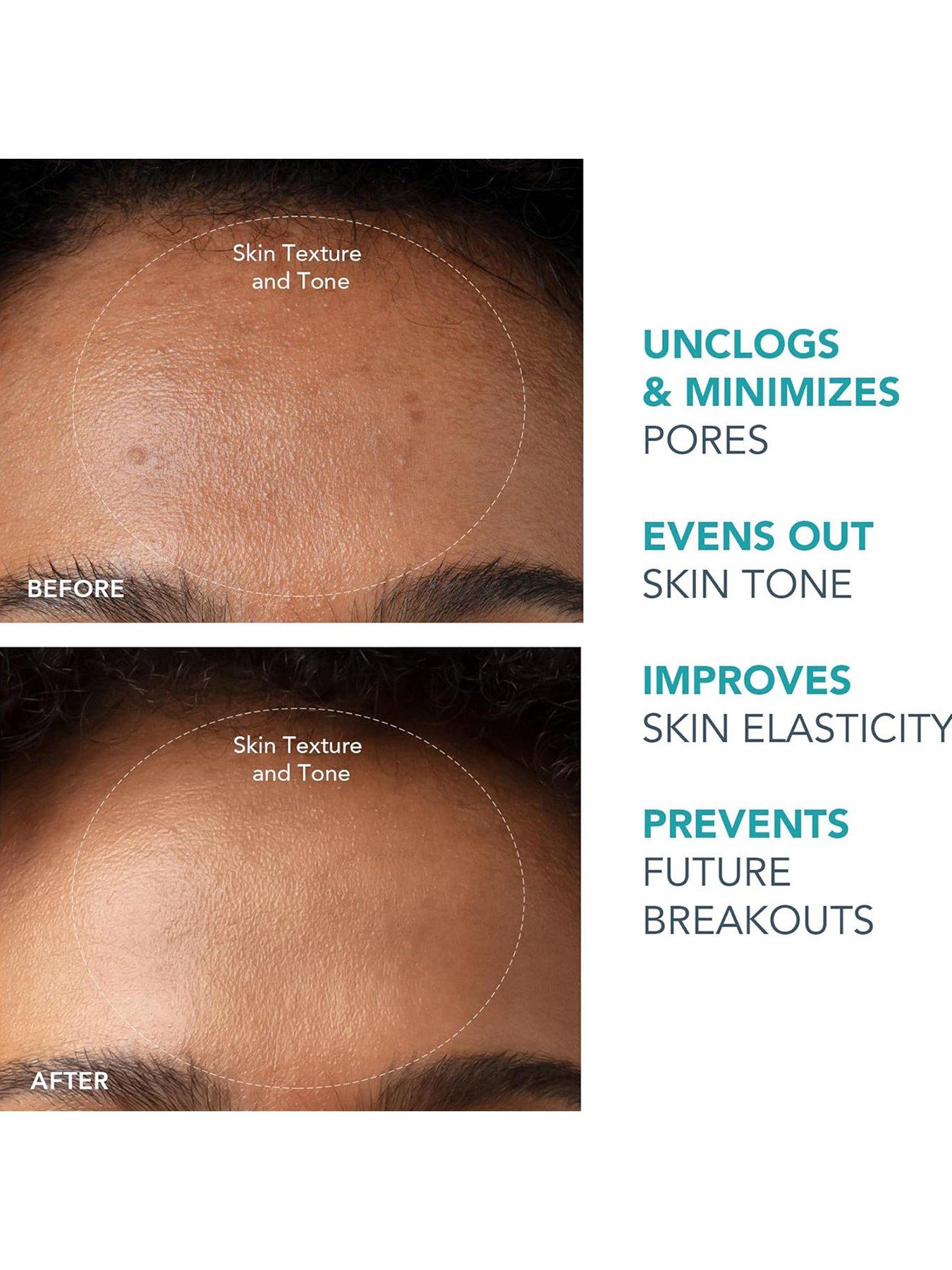 Image 4 of 4 of FOREO KIWI