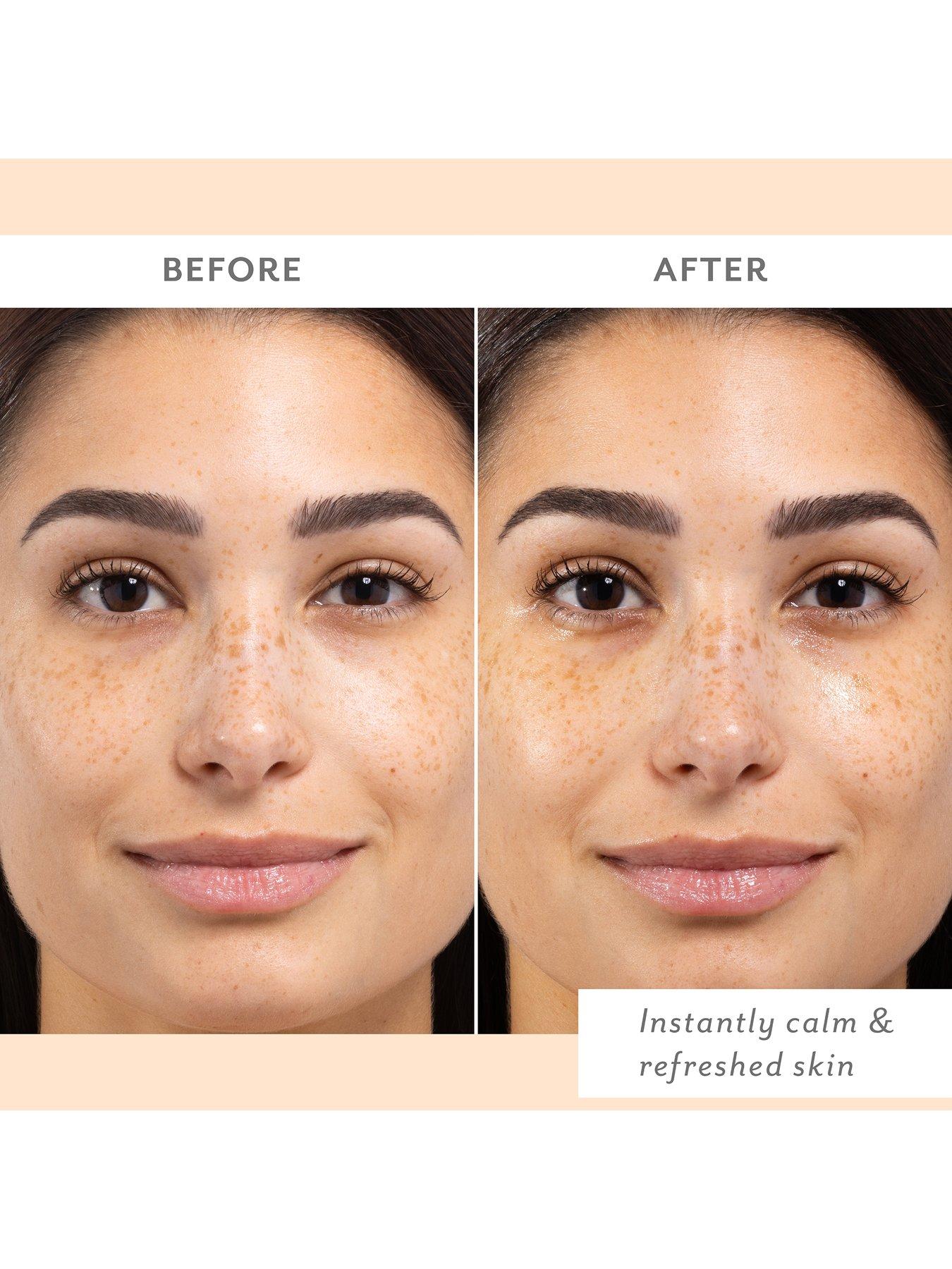 Image 6 of 7 of Patchology Skin Remedy Calm &amp; Protect Mist