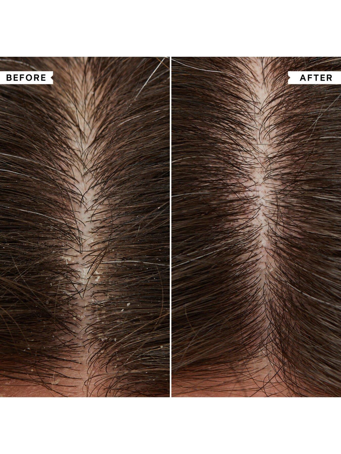 Image 4 of 7 of Philip Kingsley Flaky Itchy Scalp Shampoo 75ml