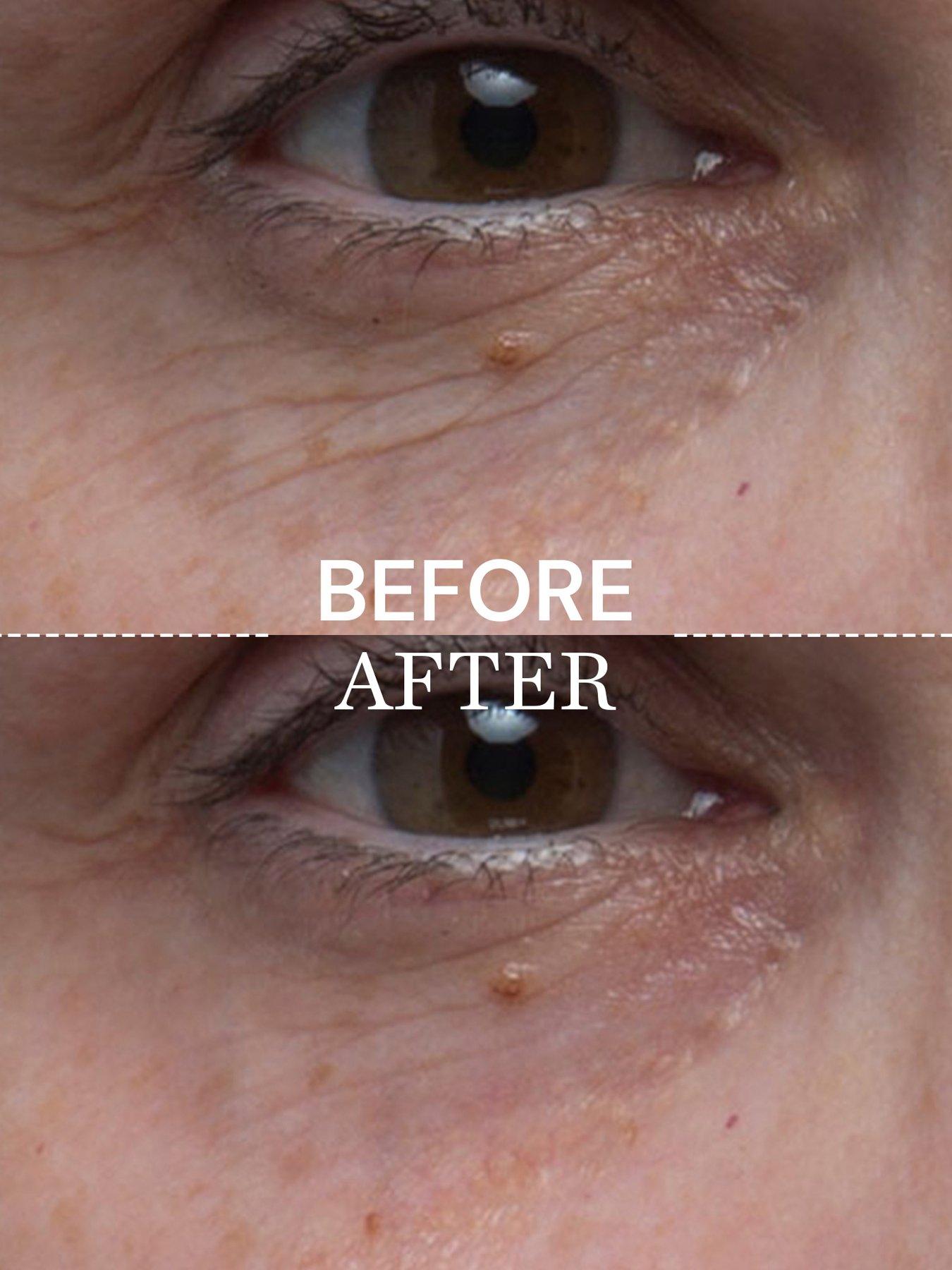 Image 3 of 4 of Elemis Pro-Collagen Future Restore Serum 30ml