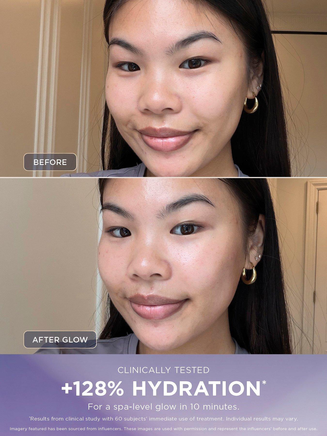 Image 3 of 8 of Shark FacialPro Glow + Depuffi at home facial - Warm Black