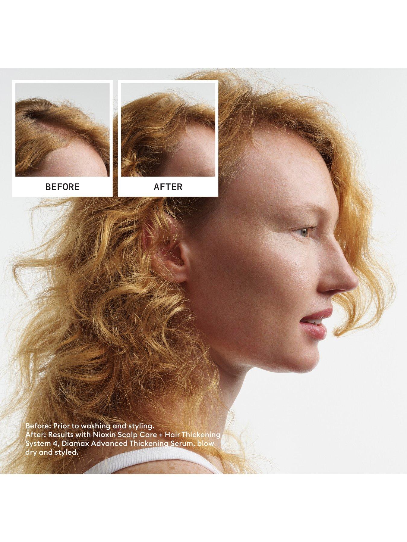 Image 6 of 7 of Nioxin Scalp + Hair Thickening System 4 for Coloured, Dry and Damaged Hair with Progressed Thinning, Loyalty Kit