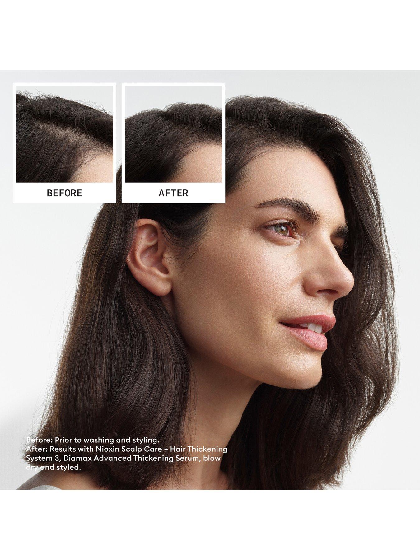 Image 6 of 7 of Nioxin Scalp + Hair Thickening System 3 for Coloured, Dry and Damaged Hair with Light Thinning, Trial Kit