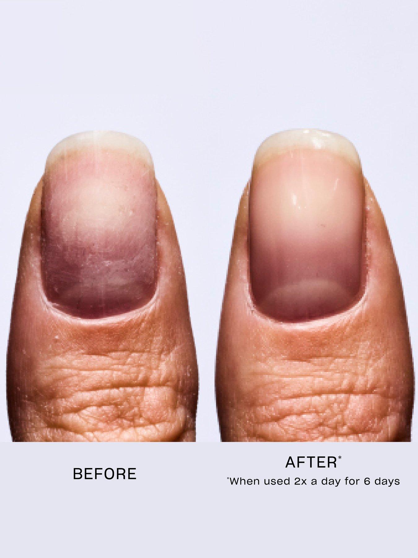  image of opi-nail-envy-pink-to-envy-nail-strengthener-15ml