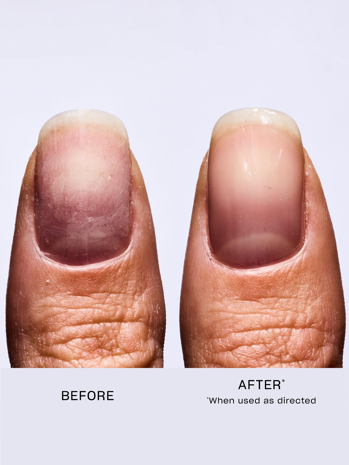  image of opi-nail-envy-original-nail-strengthener-15ml