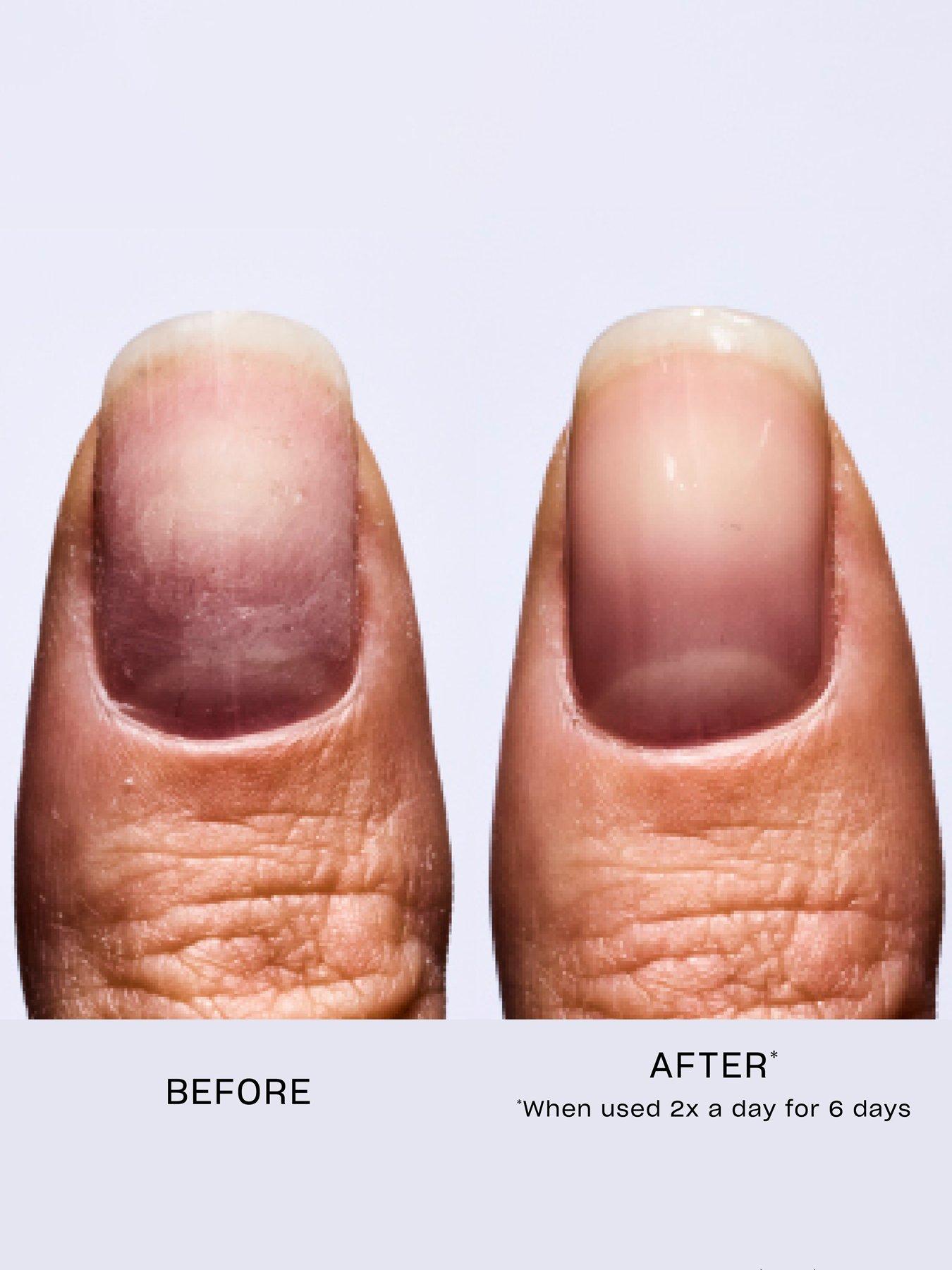 Image 4 of 7 of OPI Nail Envy Alpine Snow Nail Strengthener 15ml
