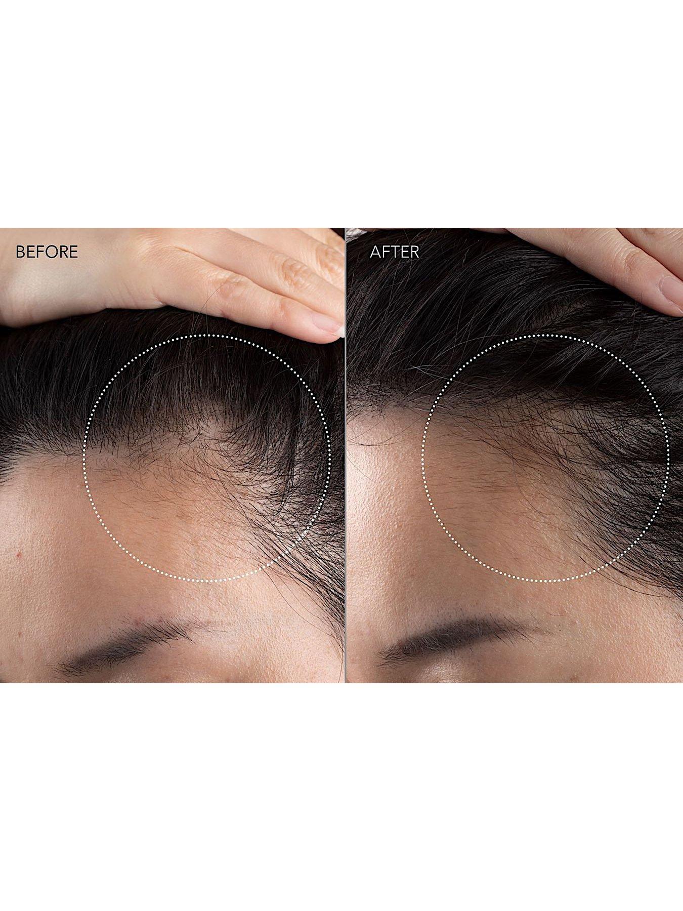 Image 4 of 5 of FOREO FAQ 301 - LED Hair Strengthening Scalp Massager