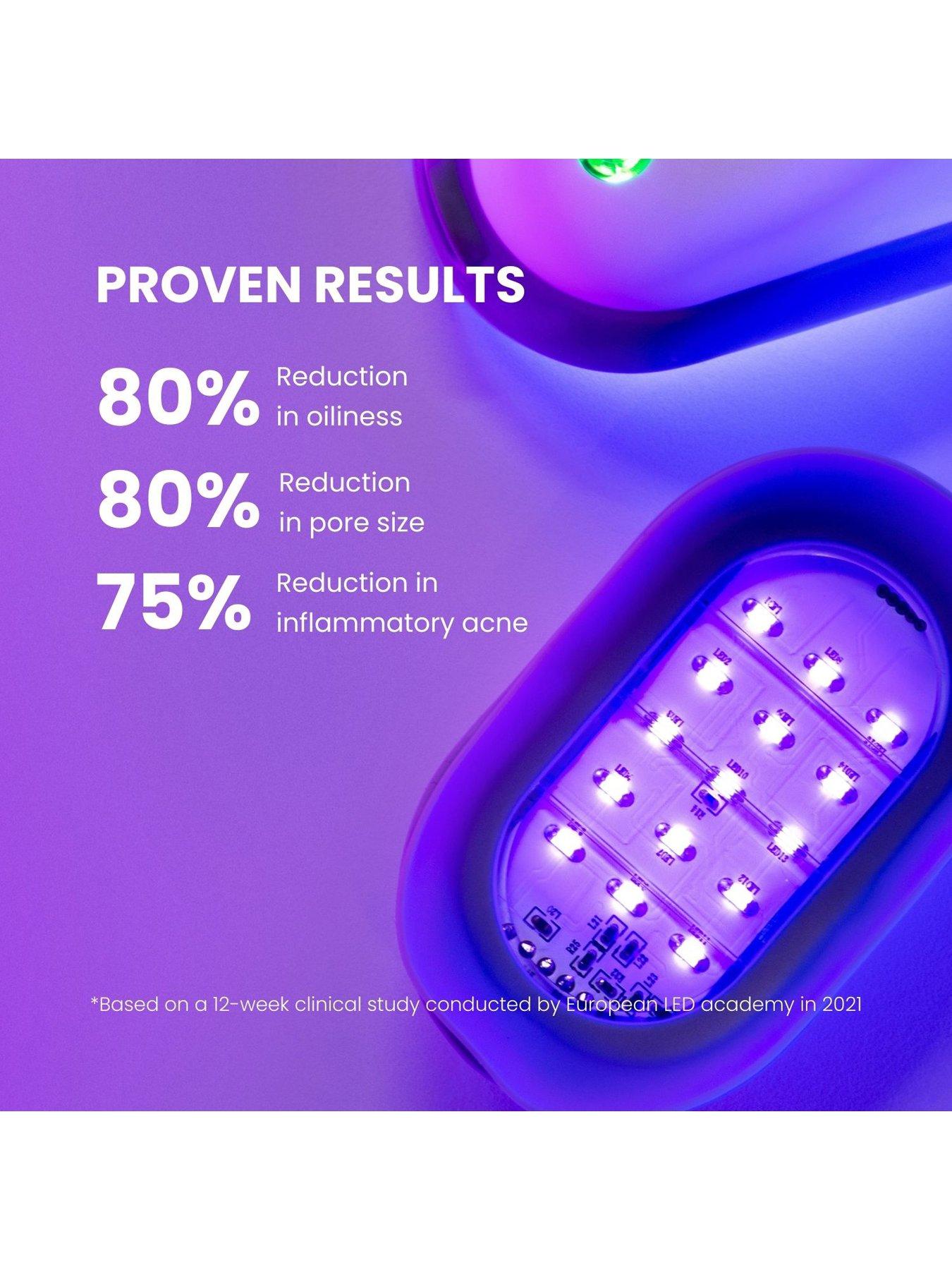  image of lustre-lustre-solo-led-acne-pod