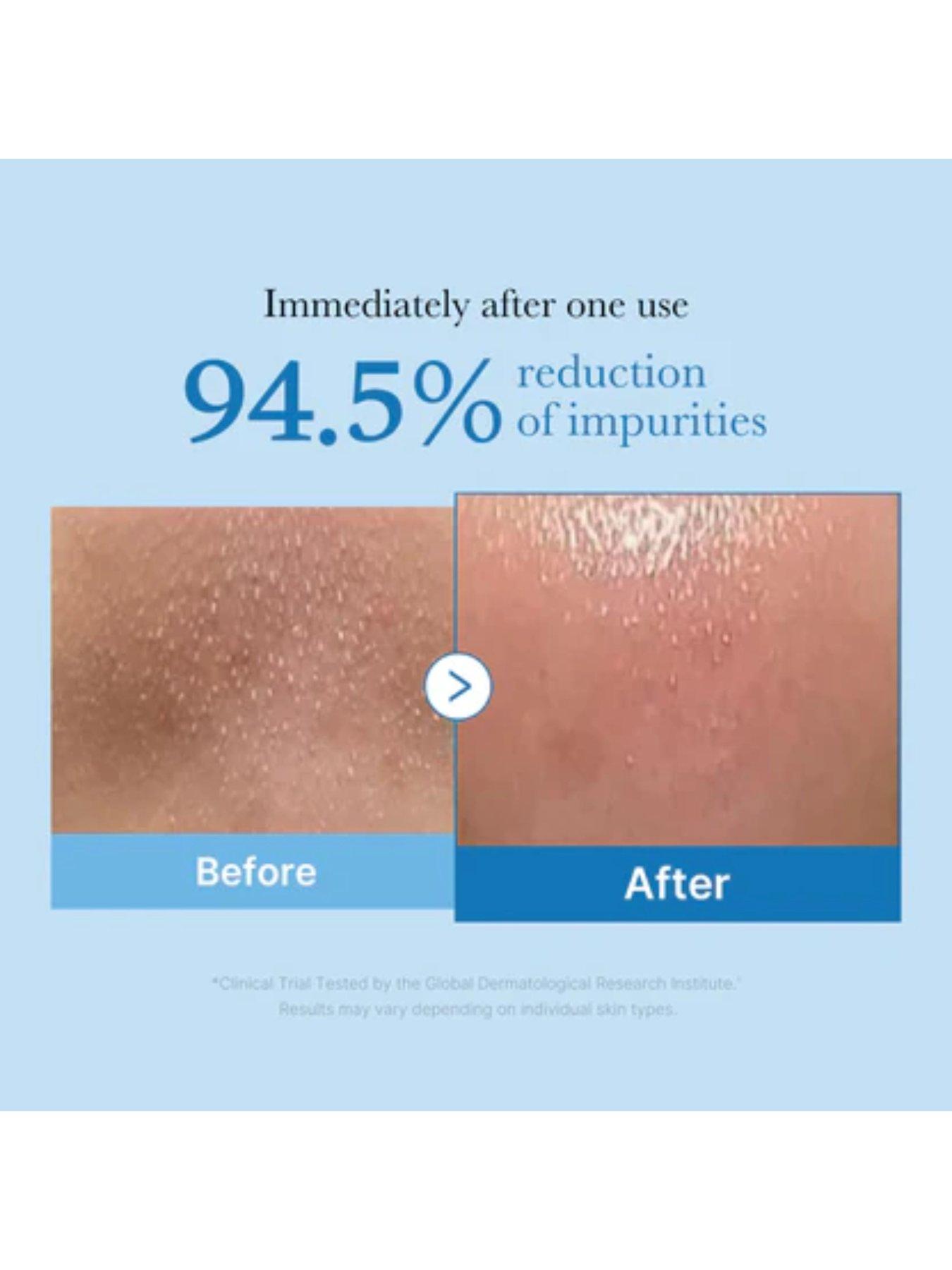 Image 5 of 5 of Medicube Pore Blackhead Deep Cleansing Oil